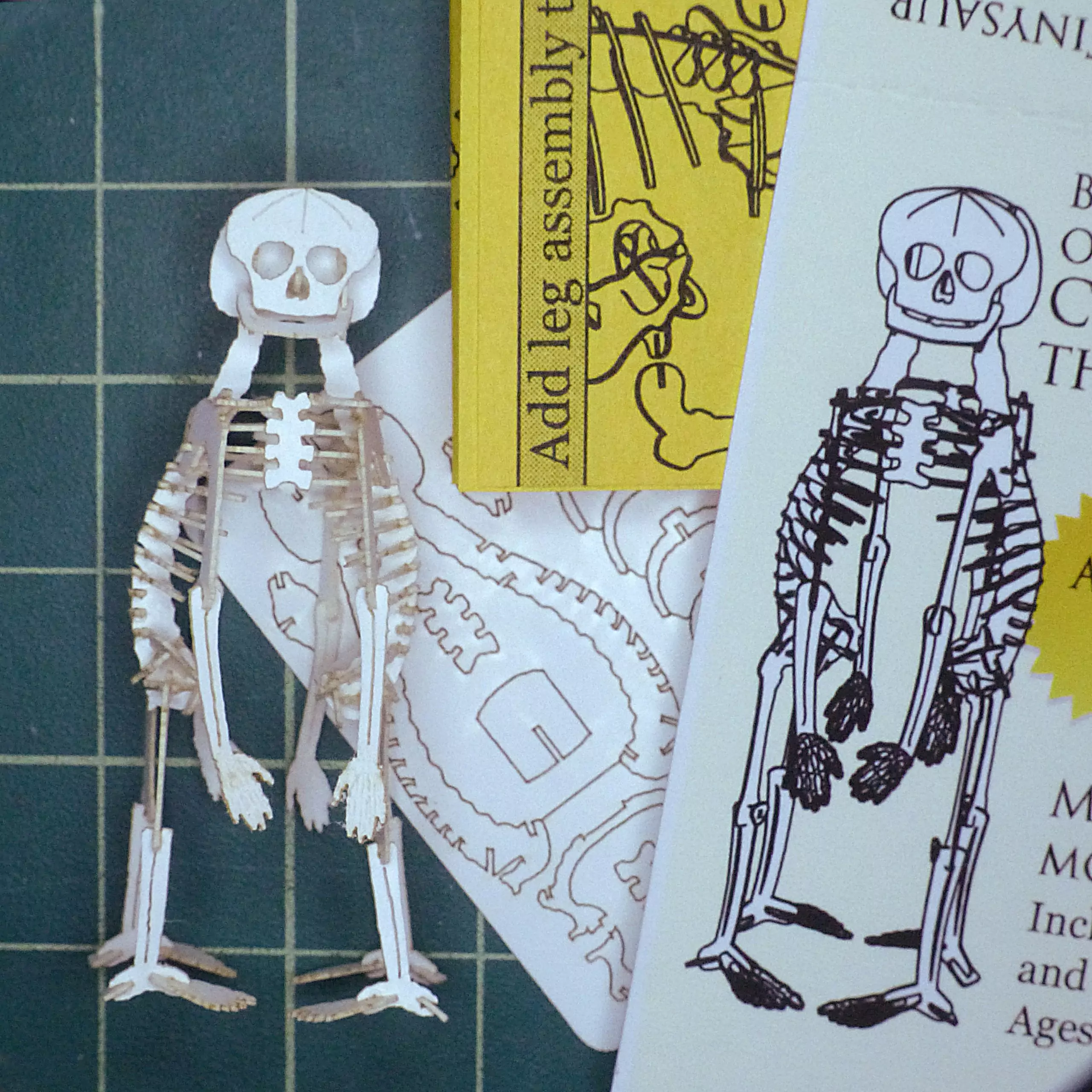 Build Your Own Cephalothoracopagus teratology miniature skeleton model - Image 6